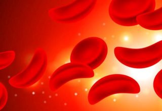 Yeni araştırma: A kan grubunun felç riski yüksek